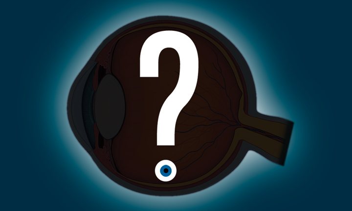 eye-anatomy-quiz
